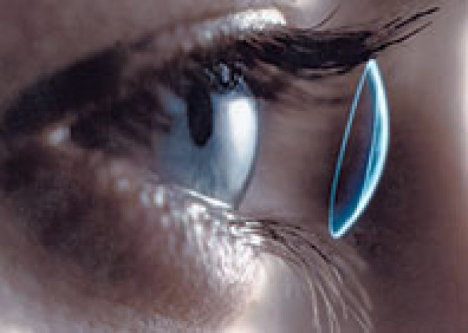 A therapeutic contact lens