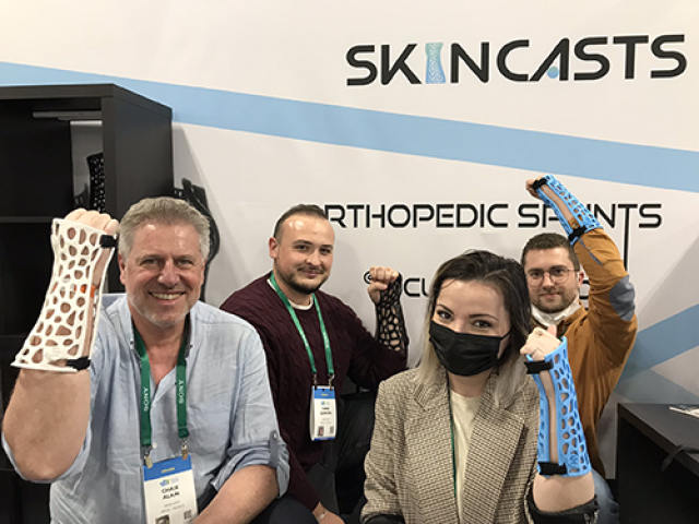 SkinCast, a new kind of 3D cast